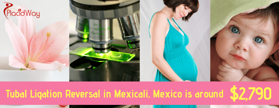 Cost Tubal Ligation Reversal in Mexicali, Mexico